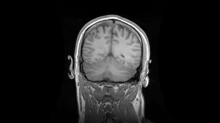 Can’t Get You Out of My Head