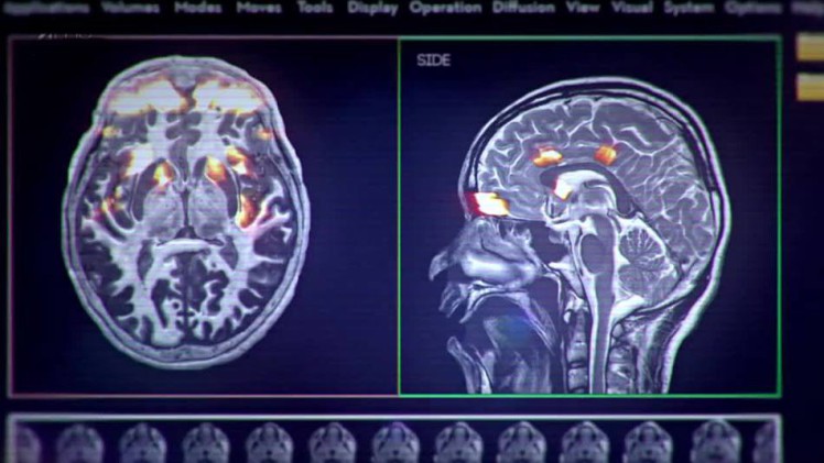 Porn on The Brain