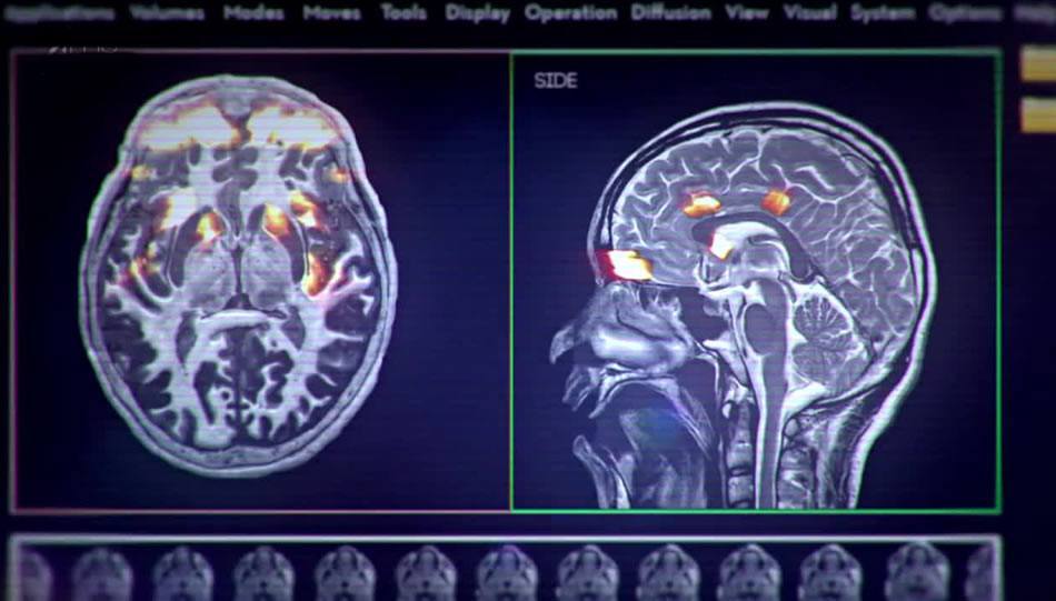 Porn on The Brain